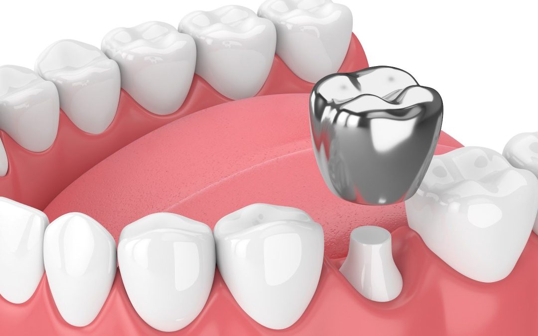 Nanoparticles of Silver: A Breakthrough in Treating Cavities and Tooth Decay Painlessly